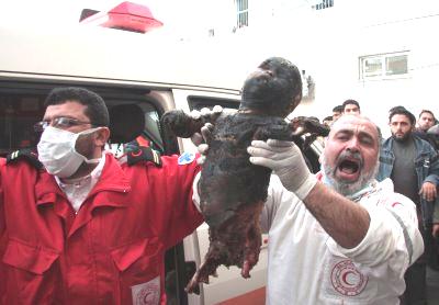 http://schema-root.org/region/middle_east/palestine/people/casualties/children/burnt_palestinian_child.jpg