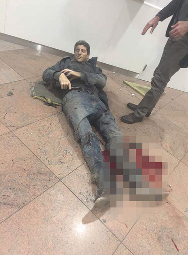 A wounded passenger lies on the floor at Brussels airport