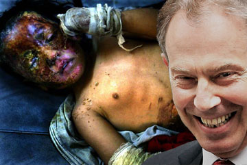 Tony Blair Iraqi Child