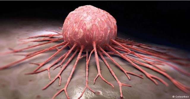 MEDICAL-BREAKTHROUGH-ANY-TYPE-OF-CANCER-CAN-BE-CURED-IN-JUST-2-6-WEEKS