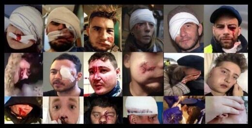 Injuries amongst the Yellow Vests